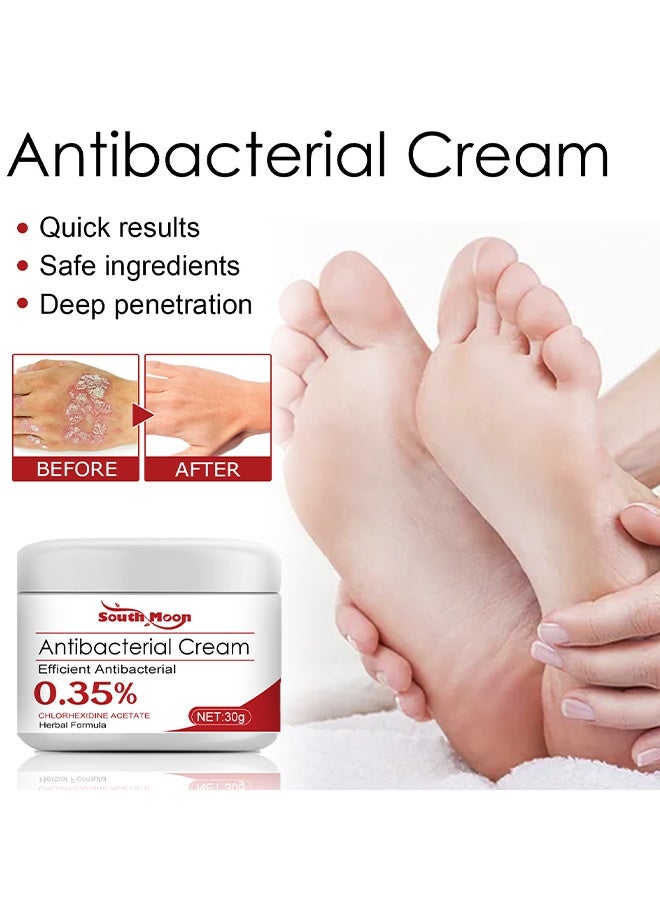 SOUTH MOON Antibacterial Cream, Psoriasis Cream, Natural Chinese Herbal Eczema Psoriasis Creams Dermatitis And Eczema Pruritus Psoriasis Ointment, Psoriasis Creams, Psoriasis Treatment, Antibacterial Cream, For Body Itching 30G - Image 4